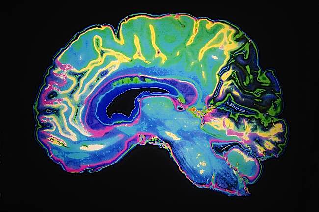 In several studies, MRI scans are used to visually measure the significant changes mindfulness meditation can achieve.