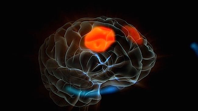 mindfulness brain mri