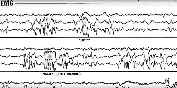 Buddha Weekly Mind activity during REM and LUCID dreaming Buddhism